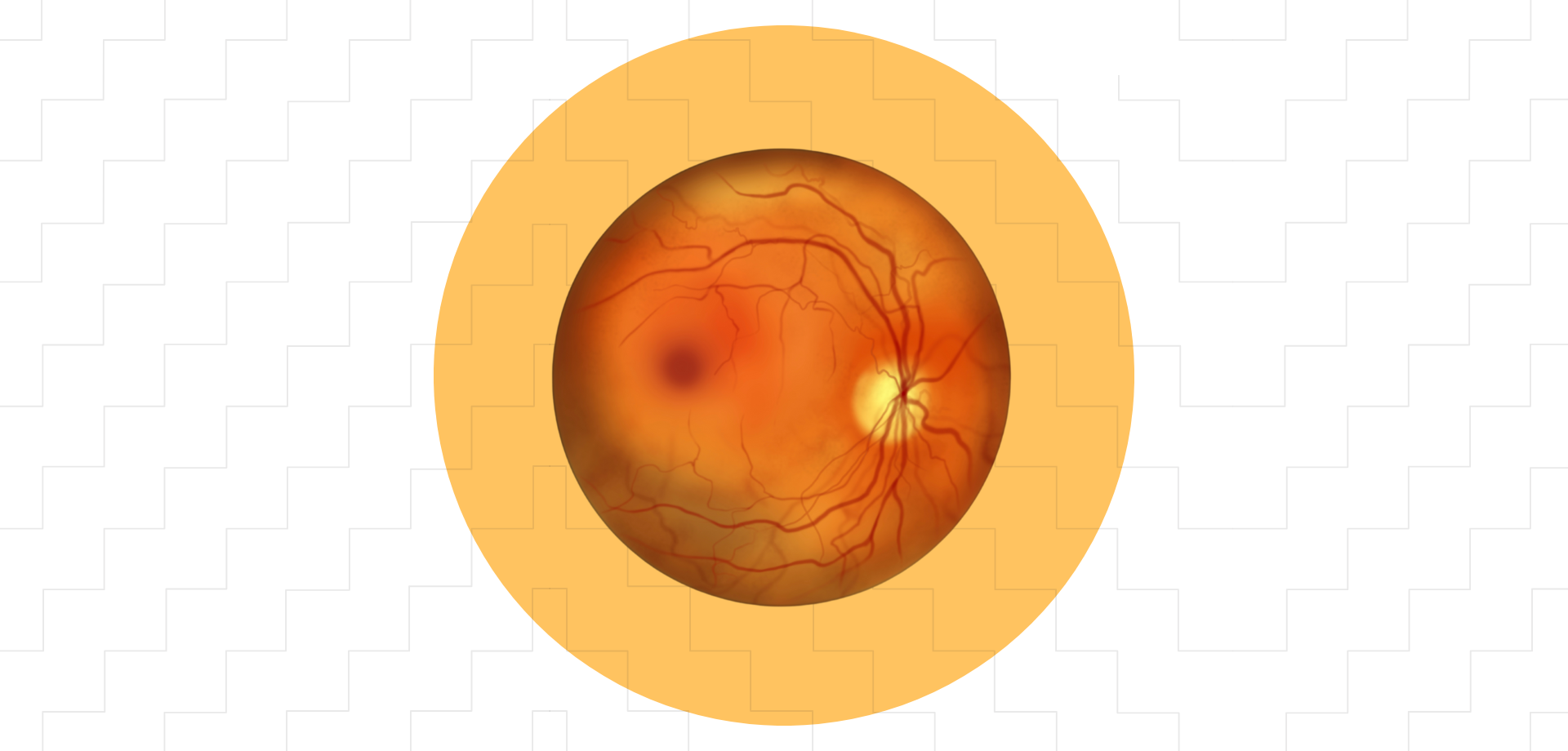 Fundus Fluorescein Angiography